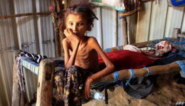  الصليب الأحمر 23.4 مليون يمني في حاجة إلى المساعدة الإنسانية